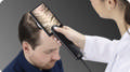 Canfield HairMetrix® konsultations software