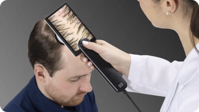 Canfield HairMetrix® konsultations software